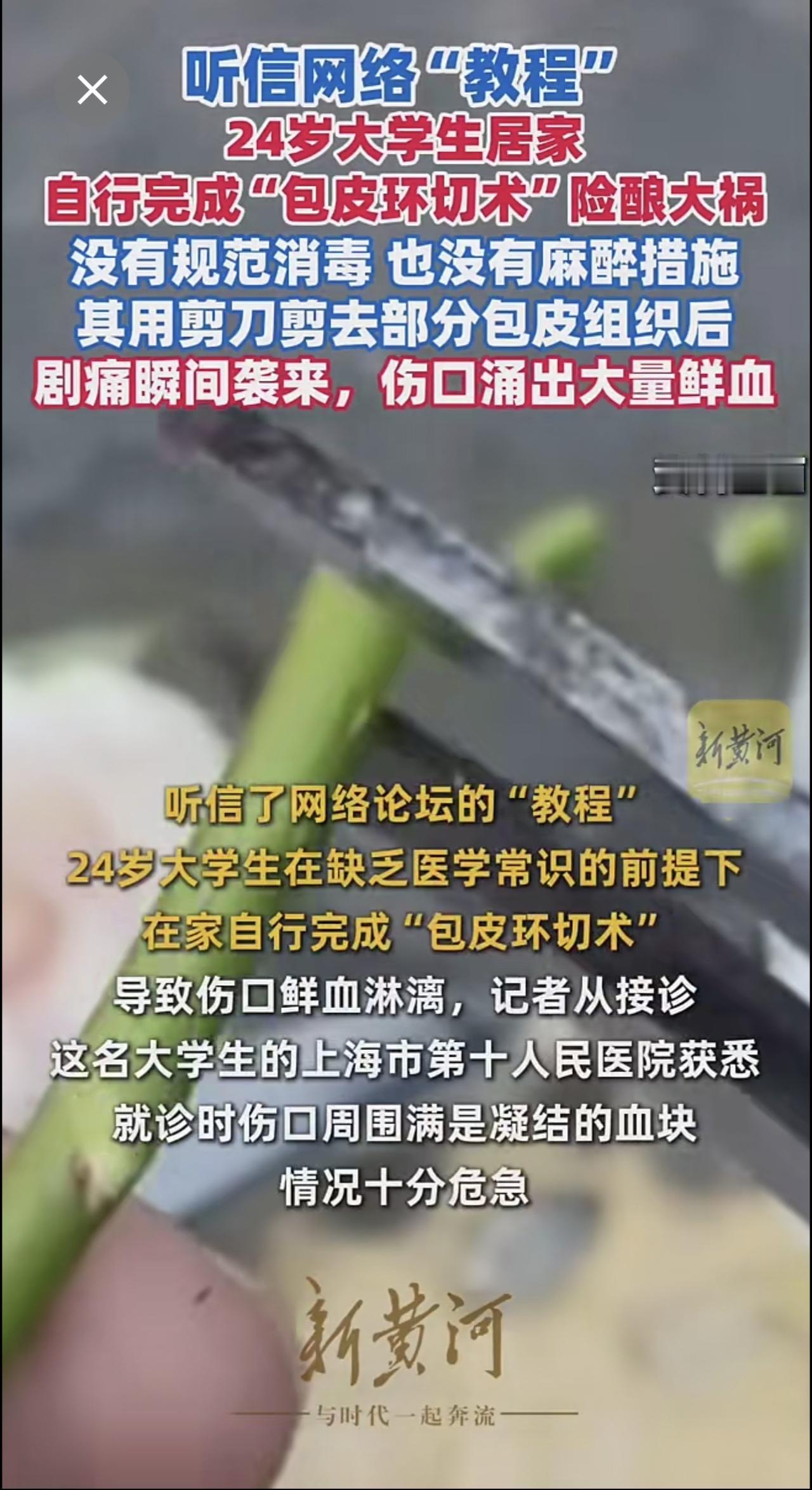 听信网络“教程”，24岁大学生居家自行完成“包皮环切术”险酿大祸 ！没有规范消毒