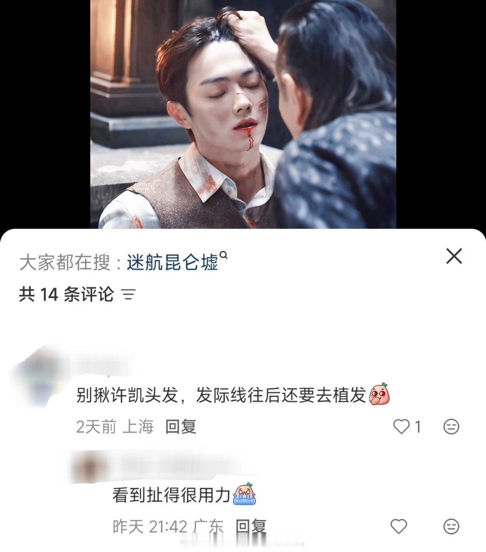许凯别看，是恶评许凯：已植发～ 