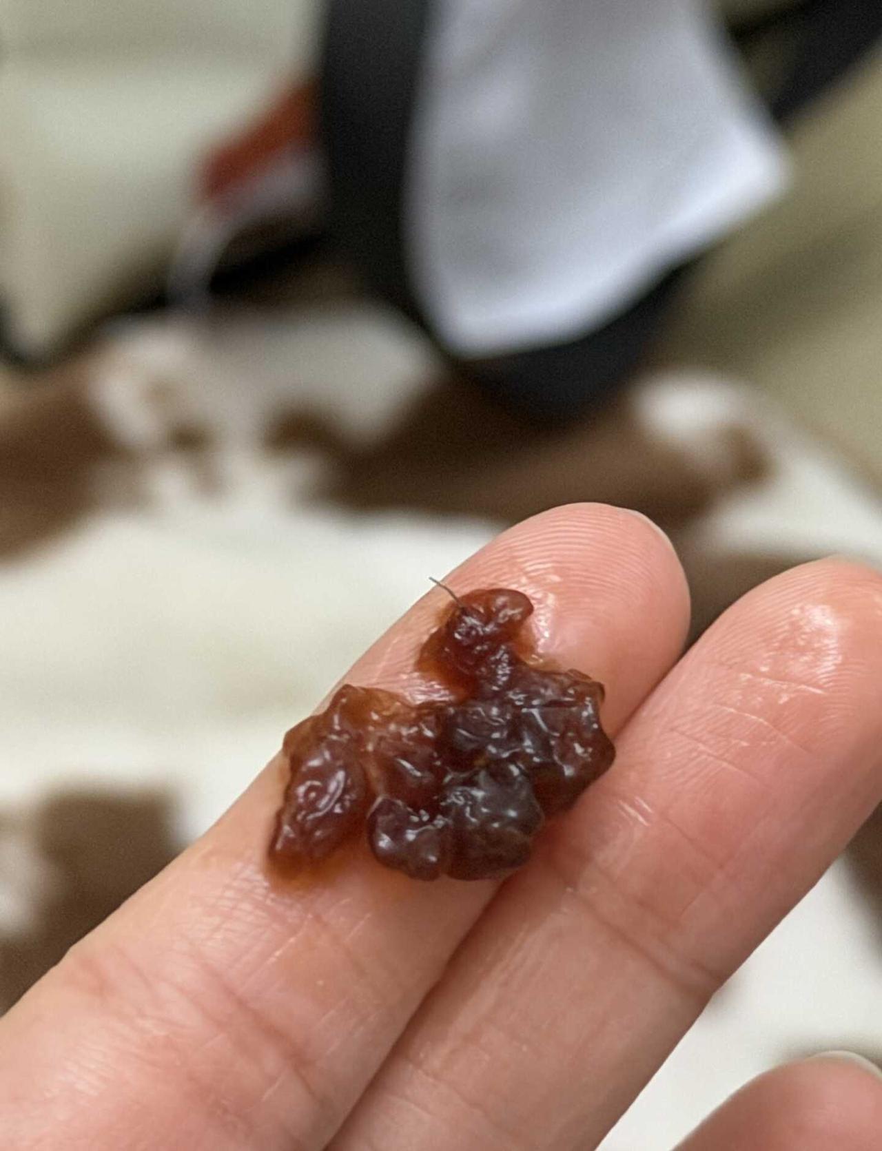 珠海泰柯茶园珍珠咬出钢丝
坐标：珠海南屏华发商都 泰柯茶园
真的被这家店恶心到了