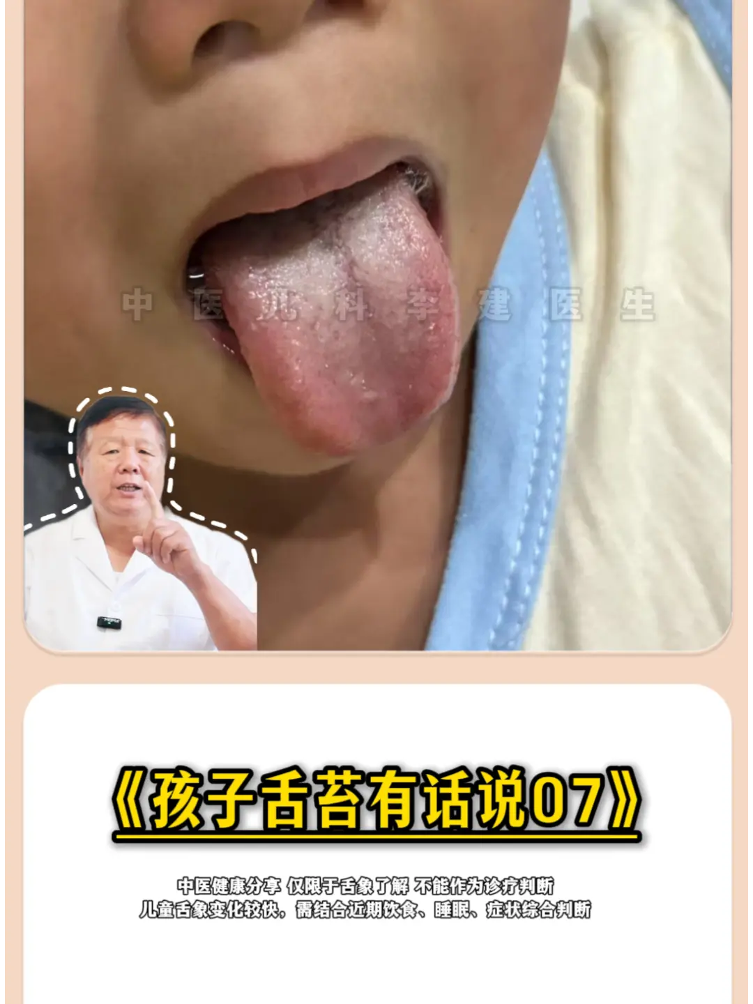 孩子舌苔有话说07。这是一位家长发过来的孩子舌照—— 孩子的舌色淡红...