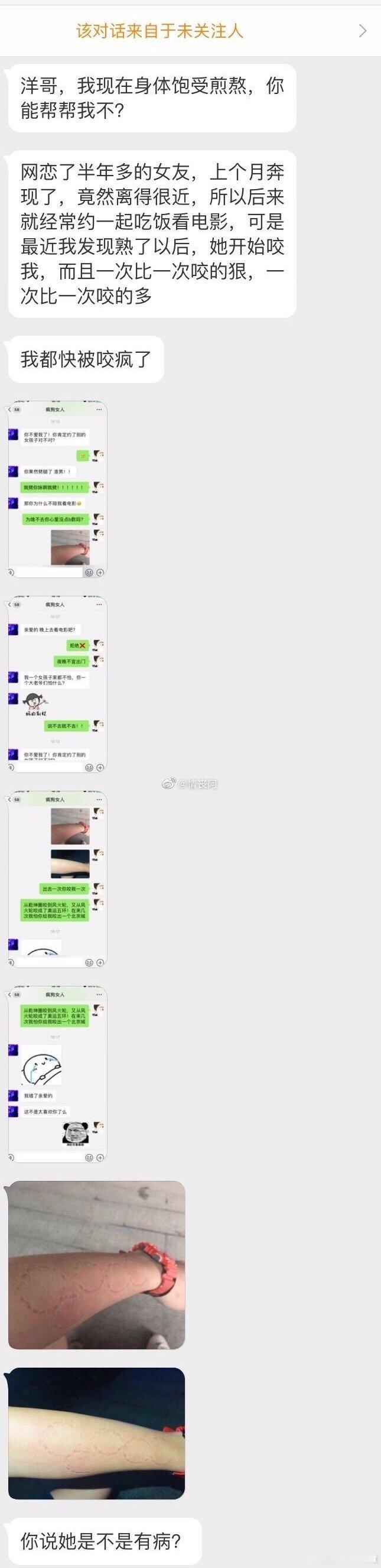 男孩遇到网恋半年的女朋友之后，胳膊都快被咬成五环了 ​​​