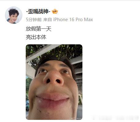 敖瑞鹏我再救你一次敖瑞鹏下巴视角   太逗！敖瑞鹏下巴视角曝光，粉丝喊 “我再救
