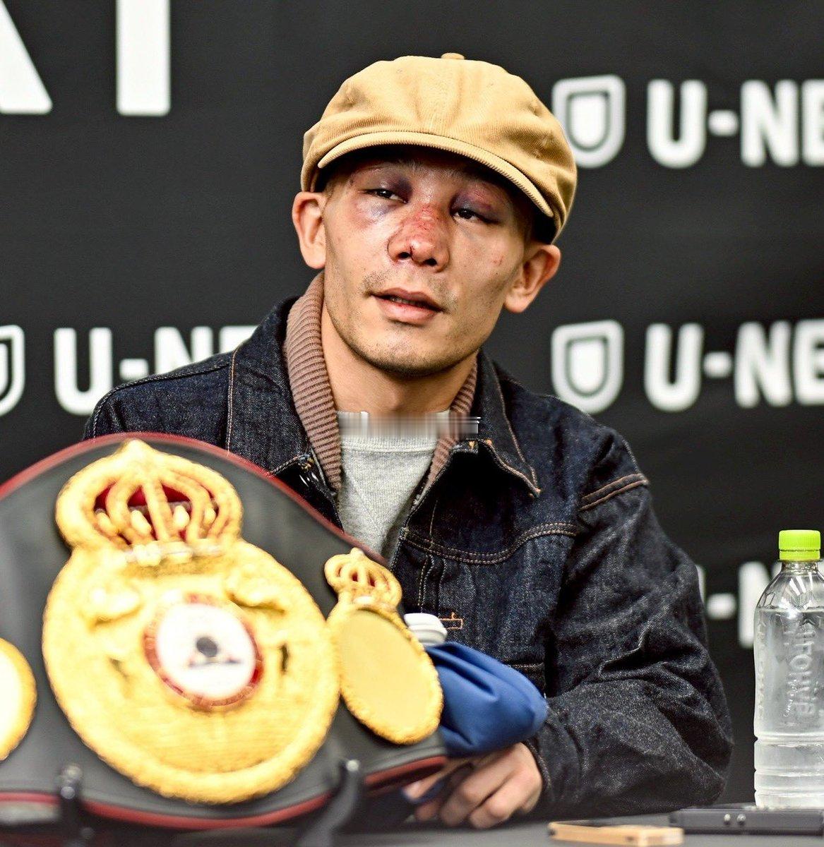 拳坛速递 堤聖也Seiya Tsutsumi  透露在昨天的比赛中，自己的鼻梁骨