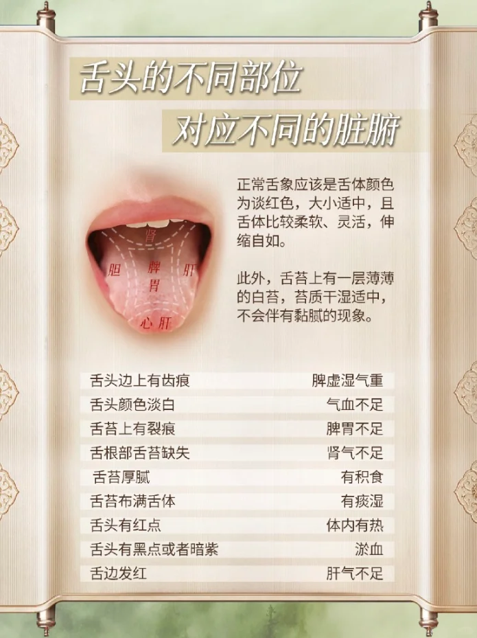 中医舌象状态表现自查✅✅✅