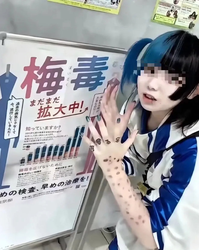 日本暴发梅毒疫情不理解那些日本人拿传染病当网红潮流，还到处拍照炫耀？[衰] ​​