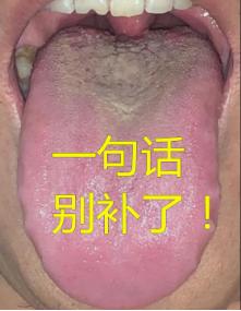 这种舌头可别补了，说了多少次，继续补就更虚了！
 
患者情况：这次遇到的蛟龙难起