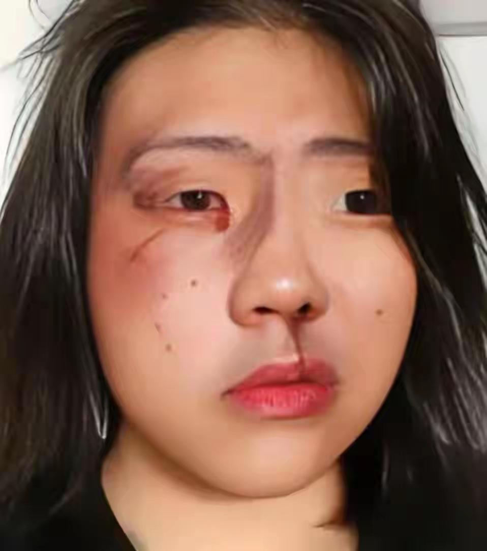 满心欢喜的去，鼻青脸肿的回！就想问问10月19日那个去九寨沟旅游的李姓女子，你是