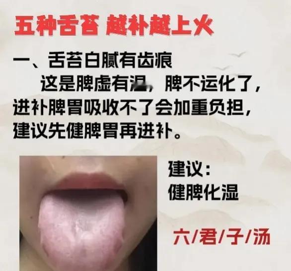 你知道吗？舌苔的颜色、质地和形状都可以反映身体的健康状况。今天我要告诉大家，有些