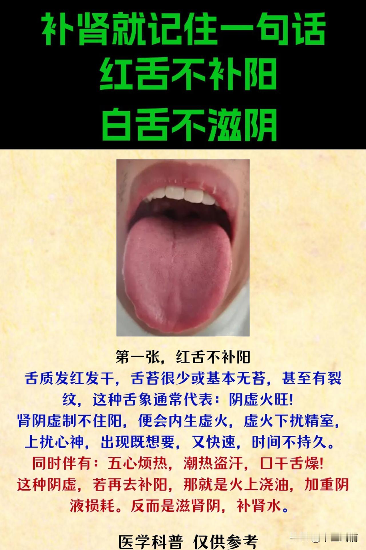 补肾就记住一句话：红舌不补阳，白舌不滋阴！#中医##健康##舌诊#