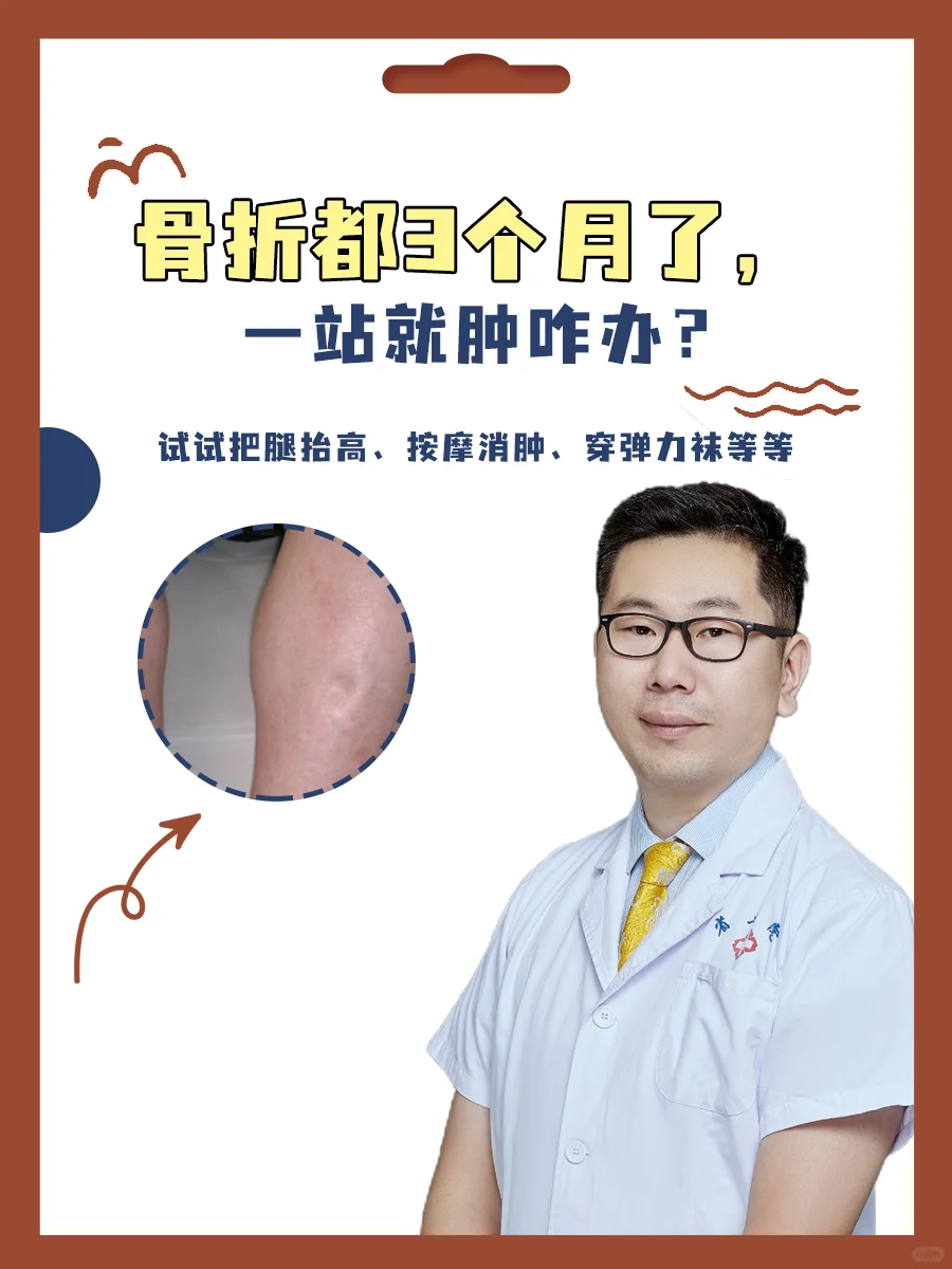 骨折三个月了一站就肿