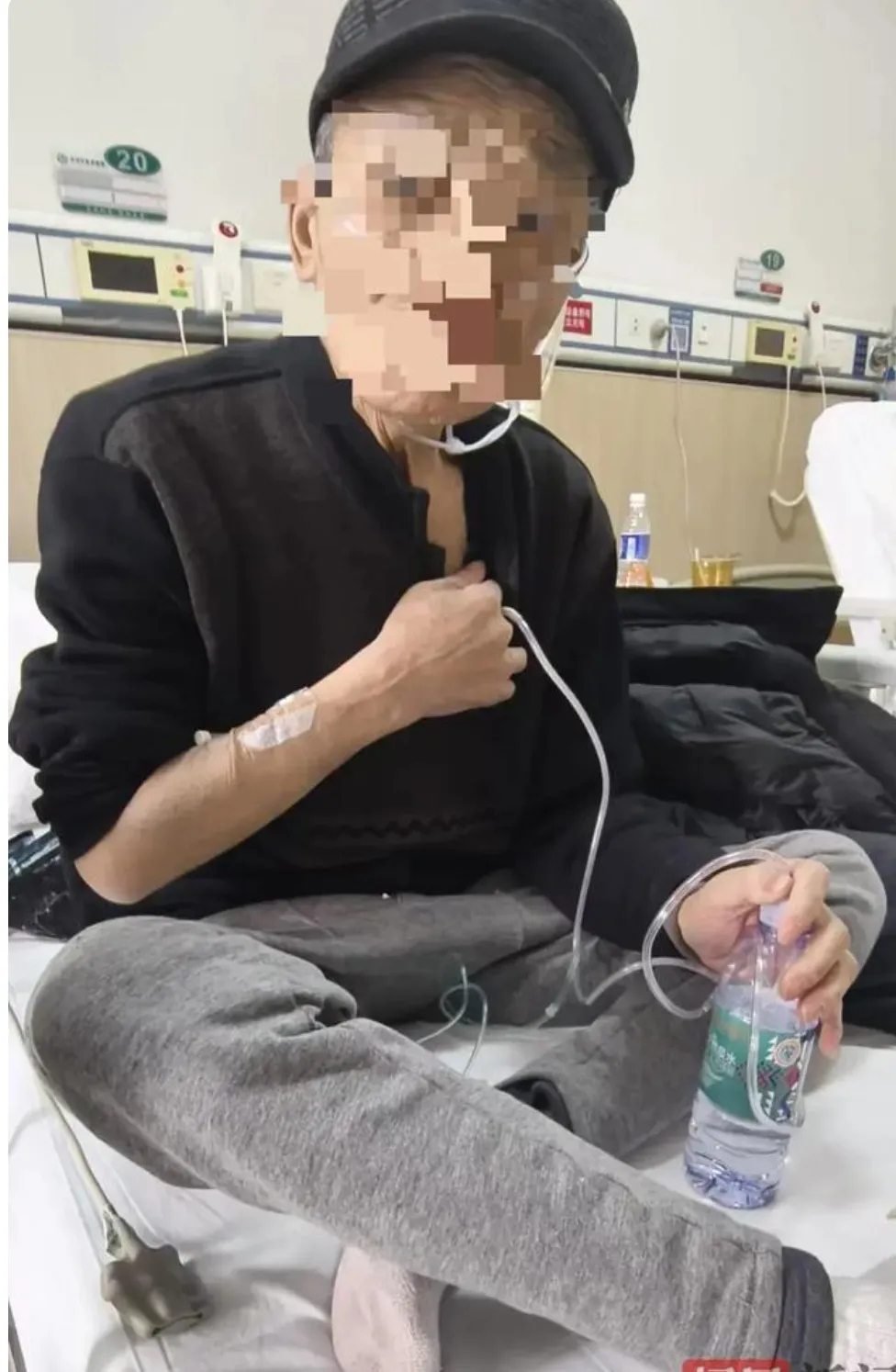 七旬老人呼吸困难自行拿剪刀捅胸排气最快的方法是疏通刺激手脚经络气血瘀堵给身体通风