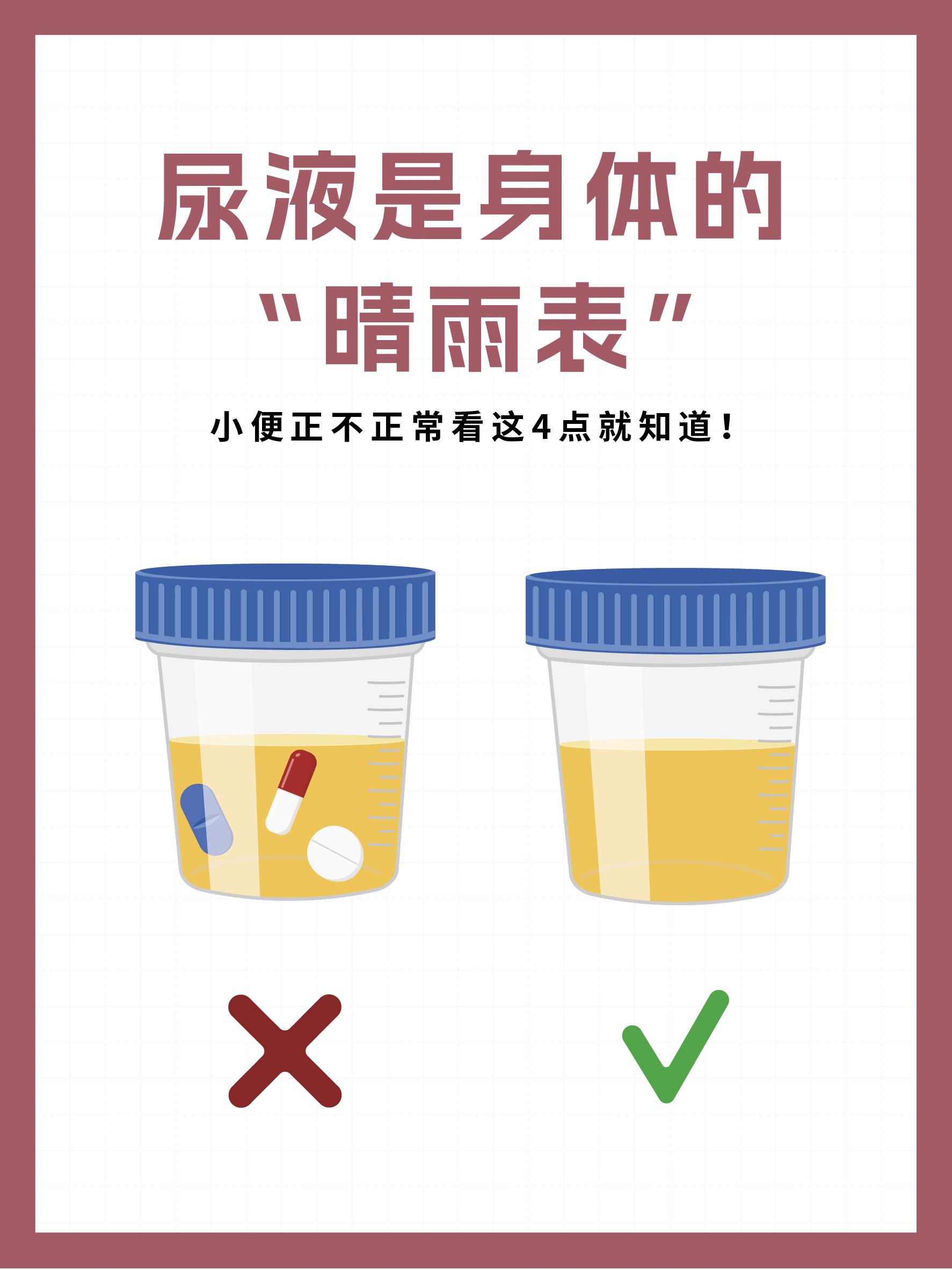 尿液是身体的“晴雨表”