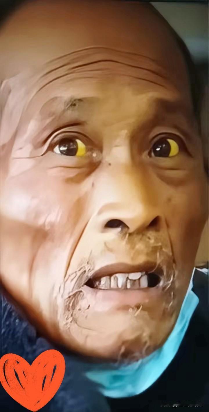 没钱的无奈！
父亲肝癌中期，儿子只能用谎言搪塞，
网友：听天由命太心酸

目前这