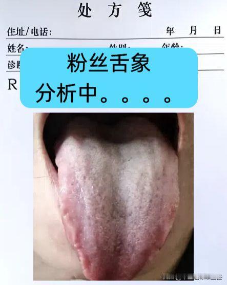 如果你怕冷又上火，体内上热下寒，记住先逍遥再交泰！

这位粉丝朋友就是上热下寒的