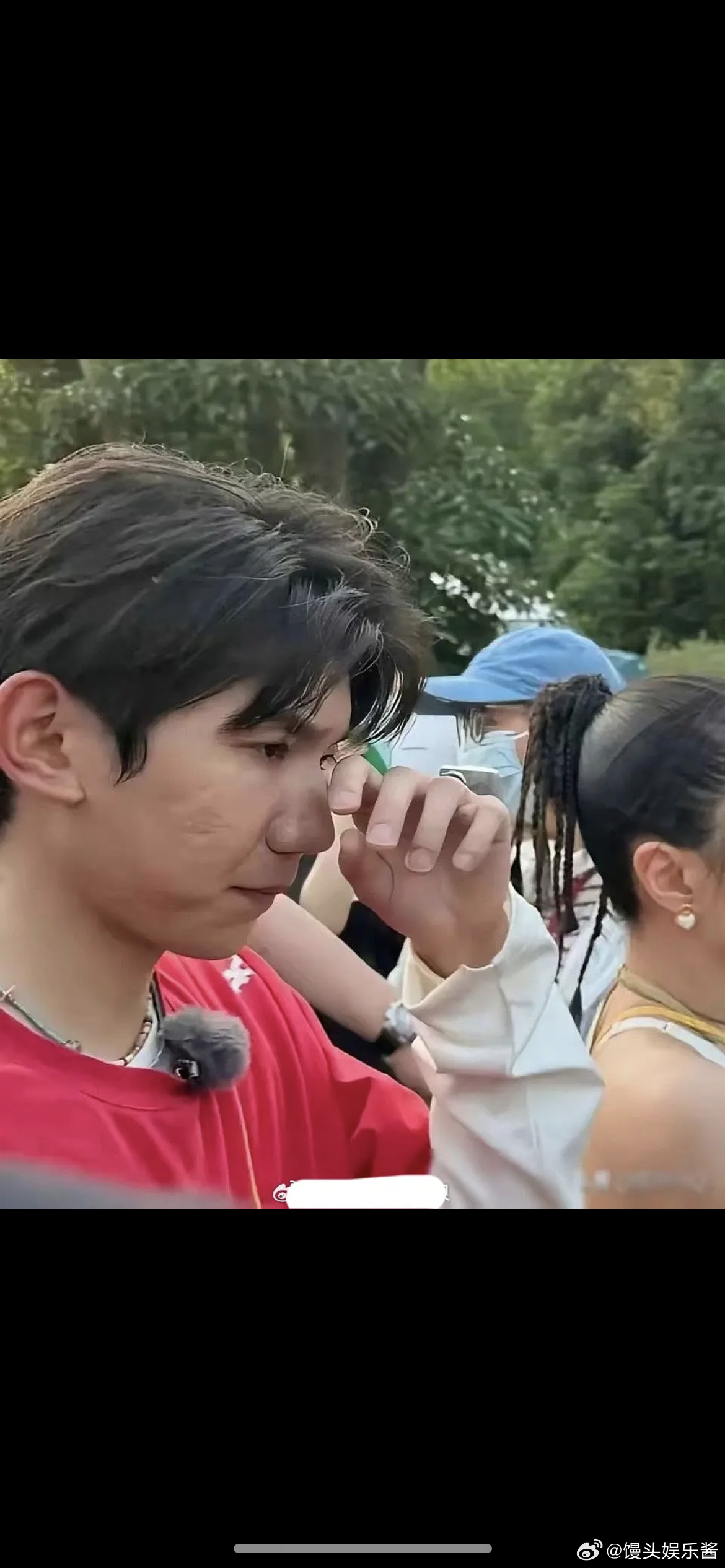 王源皮肤状态这么差吗，为什么不去去做医美改善一下