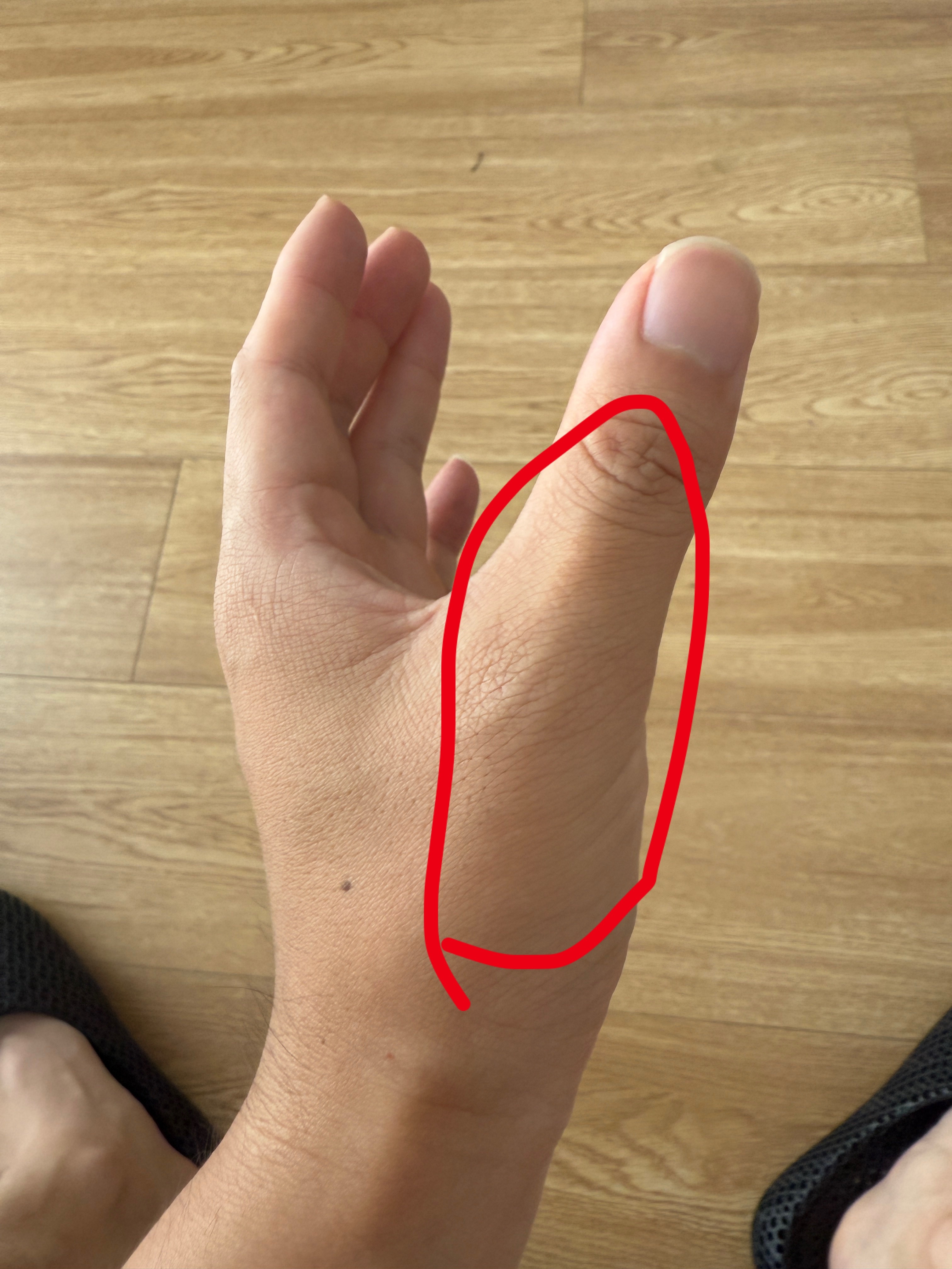 我这大拇指的关节疼了快一周了这玩意是腱鞘炎吗？兄弟们有缓解的啥方法不 ​​​
