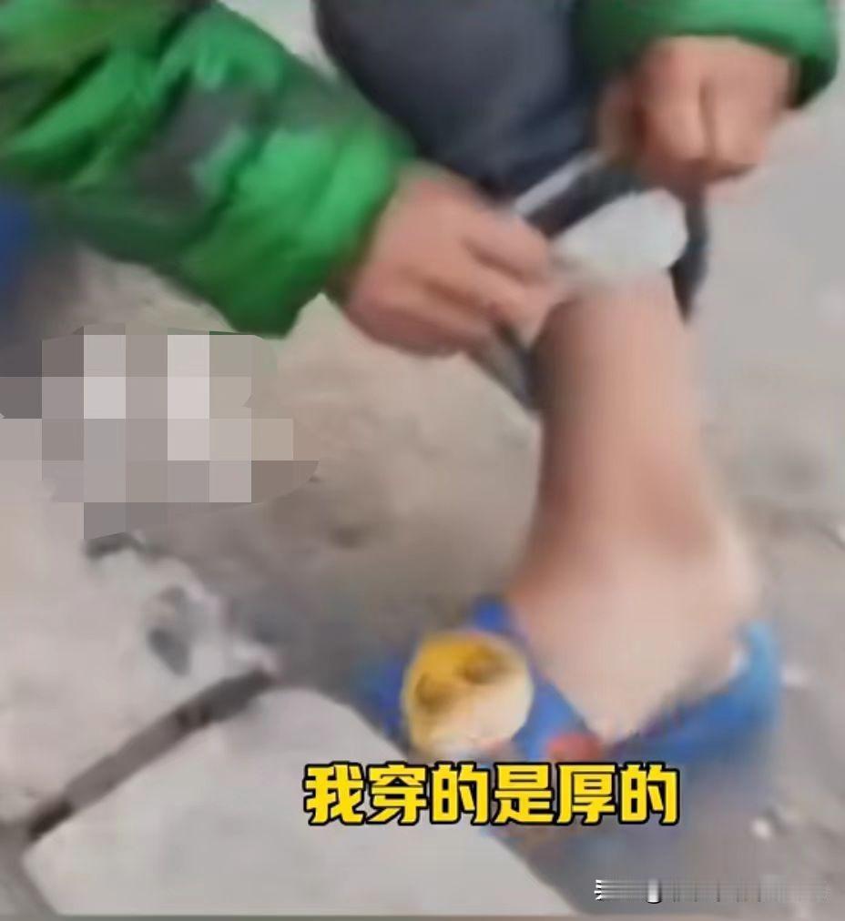 这可真是现实版的
没妈的孩子就是根草！
妈妈去世的8岁小女孩，冬天竟然
还穿着凉