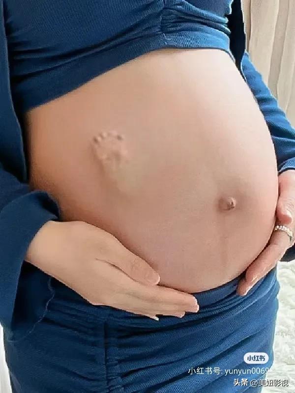 第一次怀孕，这是不是快要生了的状态？