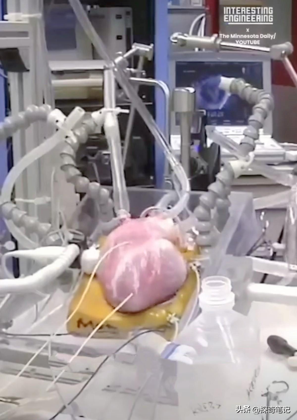 没有起搏器，单纯靠自身的电传导系统在体外跳动，这证明心脏的“自主性”远比我们想象