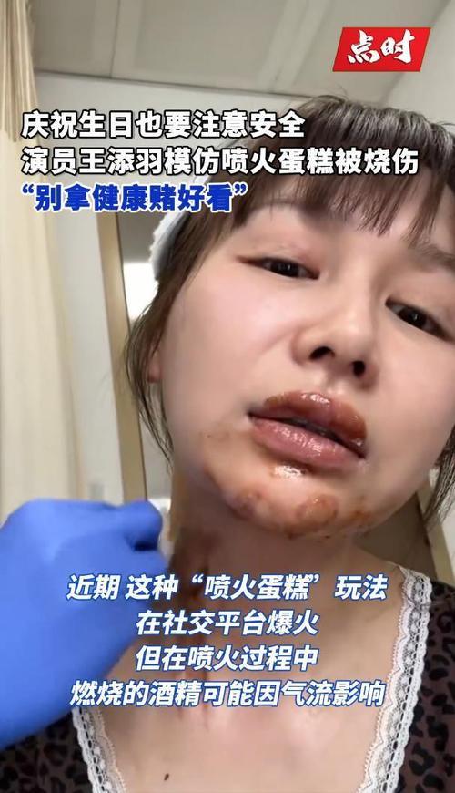 女演员王添羽生日时，为拍氛围感视频模仿网红“喷火蛋糕”玩法，口含96度高度酒喷向