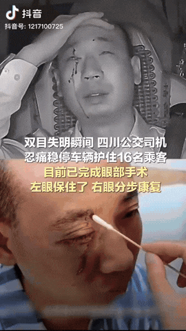 9月22日，一四川公交车驾驶员在行车时遭遇意外，双目受伤，令人感动的是他忍着剧痛