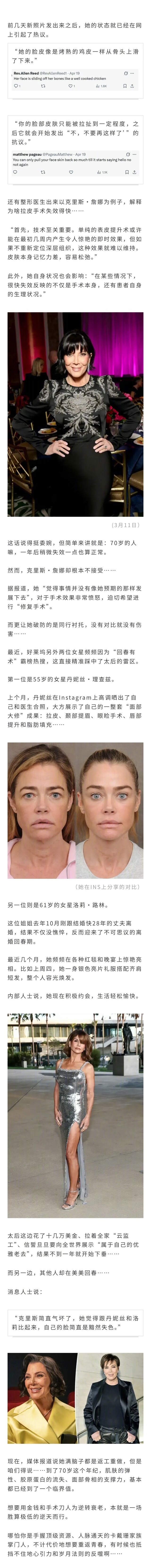 卡戴珊家太后克里斯·詹娜去年一波拉皮手术，状态大回春惊呆全球。结果，不到一年就被