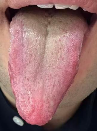 顽固宗筋疲软难痊愈？疏通瘀堵打通阳道是治本之法






很多朋友年纪轻轻就受