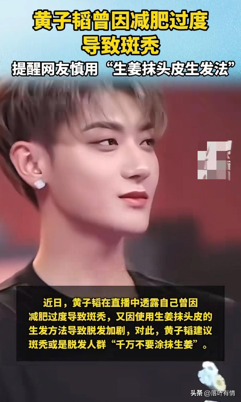 谁能想到这么帅的黄子韬，
居然是个秃顶，
原来是因为自己减肥，
减得太厉害了，