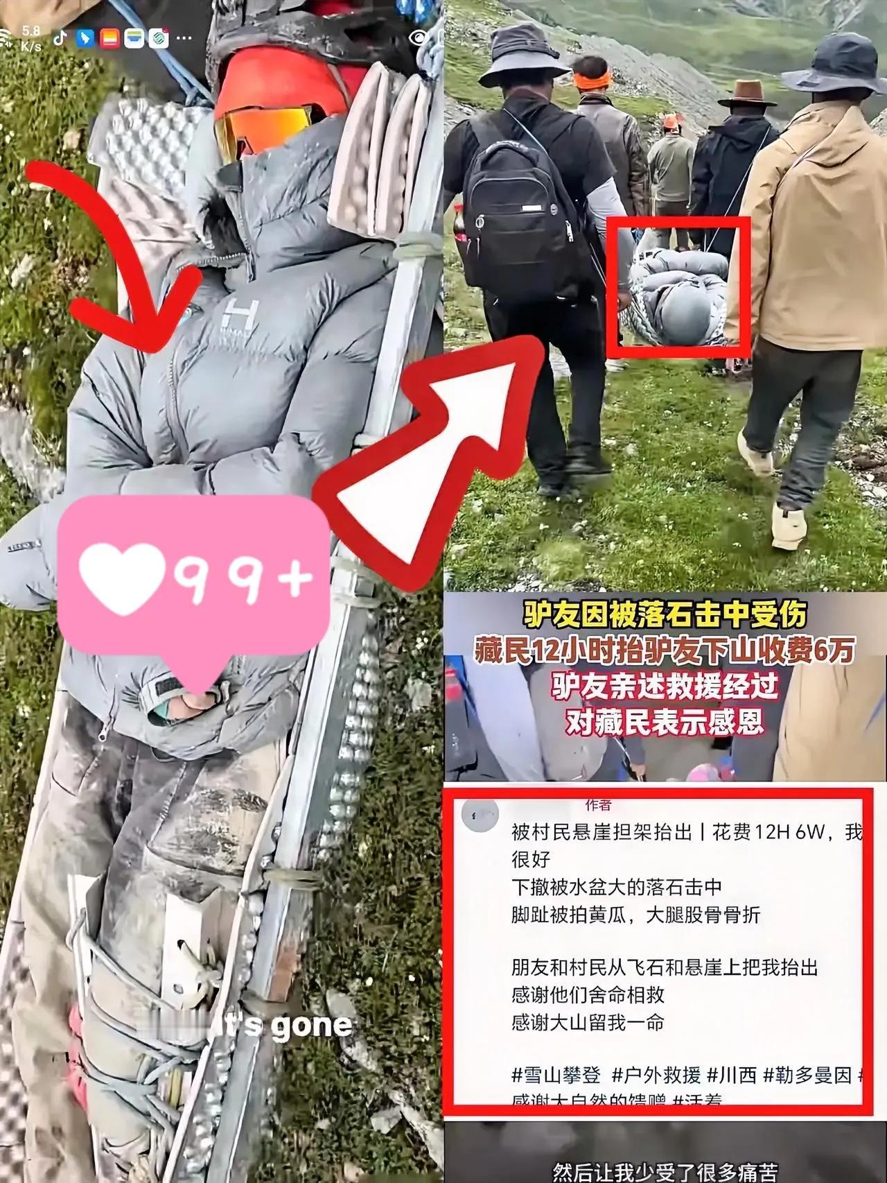 终于弄明白了，
骨折女孩为什么同意6万块下山了，
不是讹钱，而是她
真的没第二条
