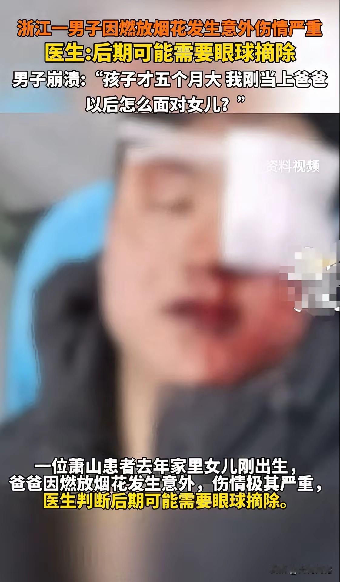 春节期间，浙江的这个男子可是够倒霉的了，在燃放鞭炮的时候，把自己的眼睛弄伤了，伤