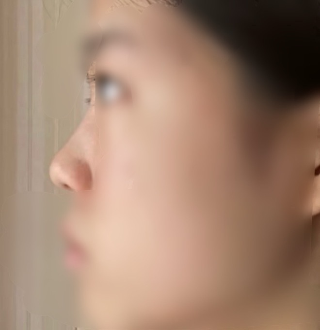 鼻塌bug易不自信易受他人影响听听这个有理，听听那个也有理缺独立思考能力注意根源