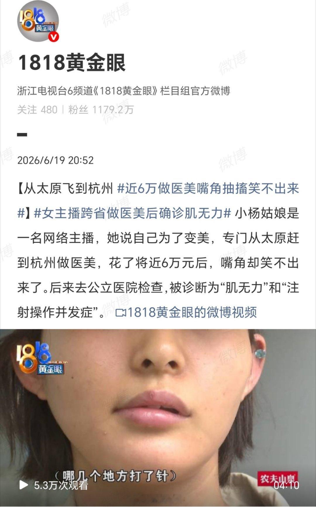 近6万做医美嘴角抽搐笑不出来“难怪现在很多美女是嘴歪眼斜，刚开始以为是她们太傲慢