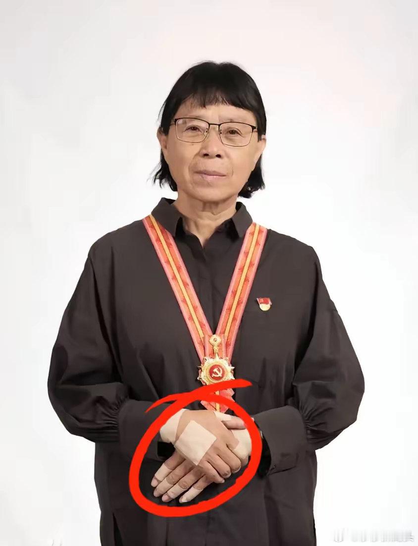 张桂梅，快七十的女校长，时常咳嗽，身体不太好，手也会肿得缠满膏药……​可她依然是