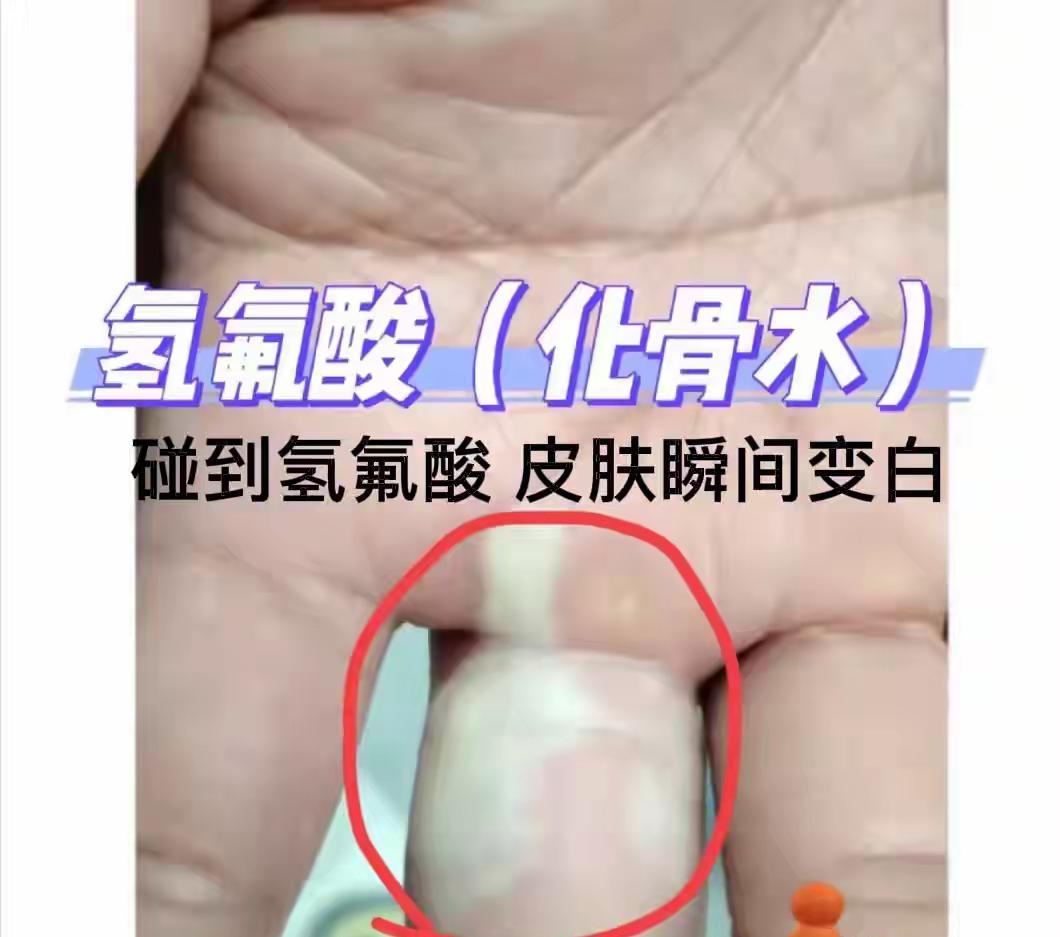 这是祸从天降
女子散步踩氢氟酸（俗称化骨水）去世了

9月9日杭州52岁的涂女士