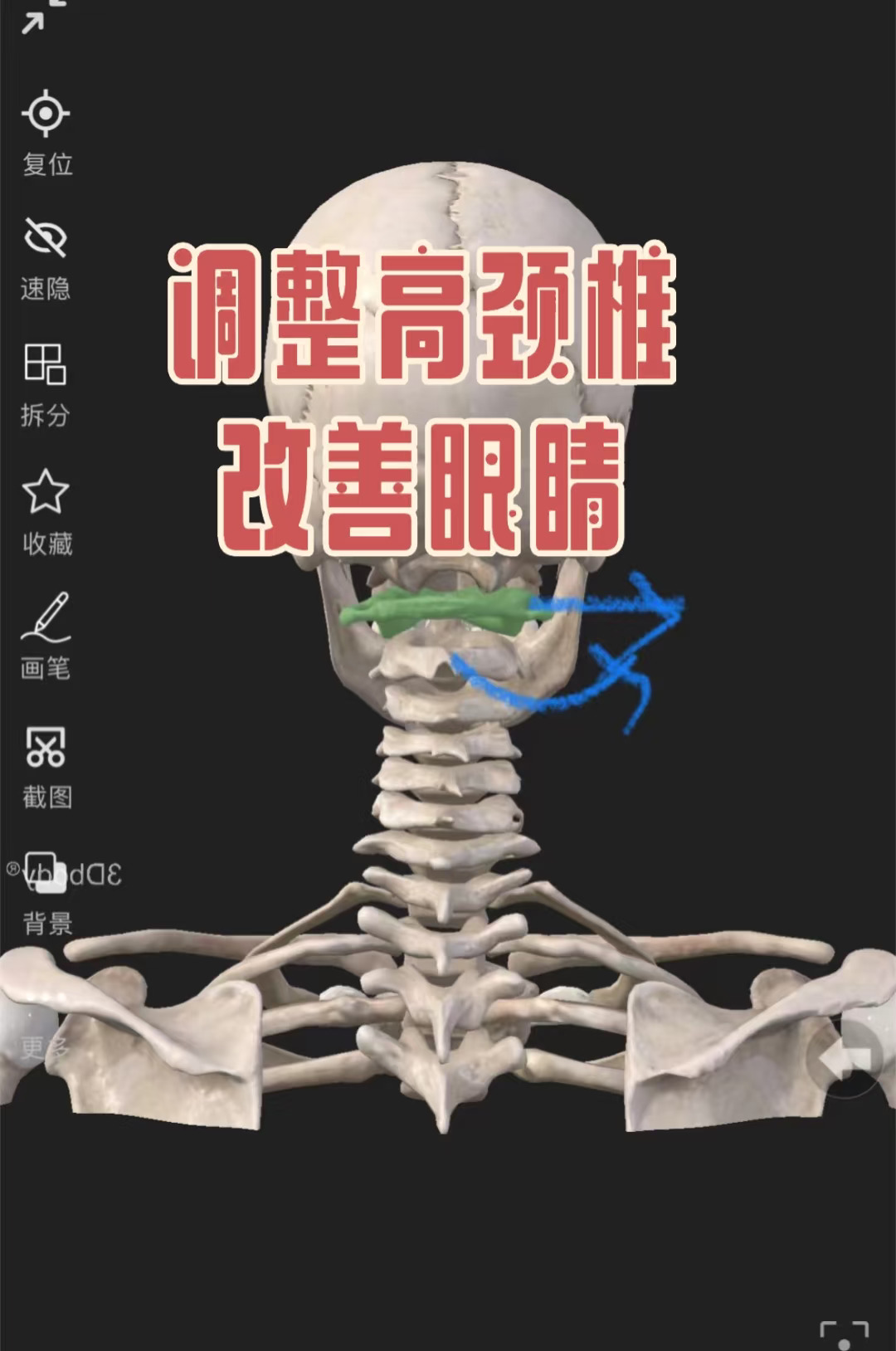 调整高颈椎改善眼睛
