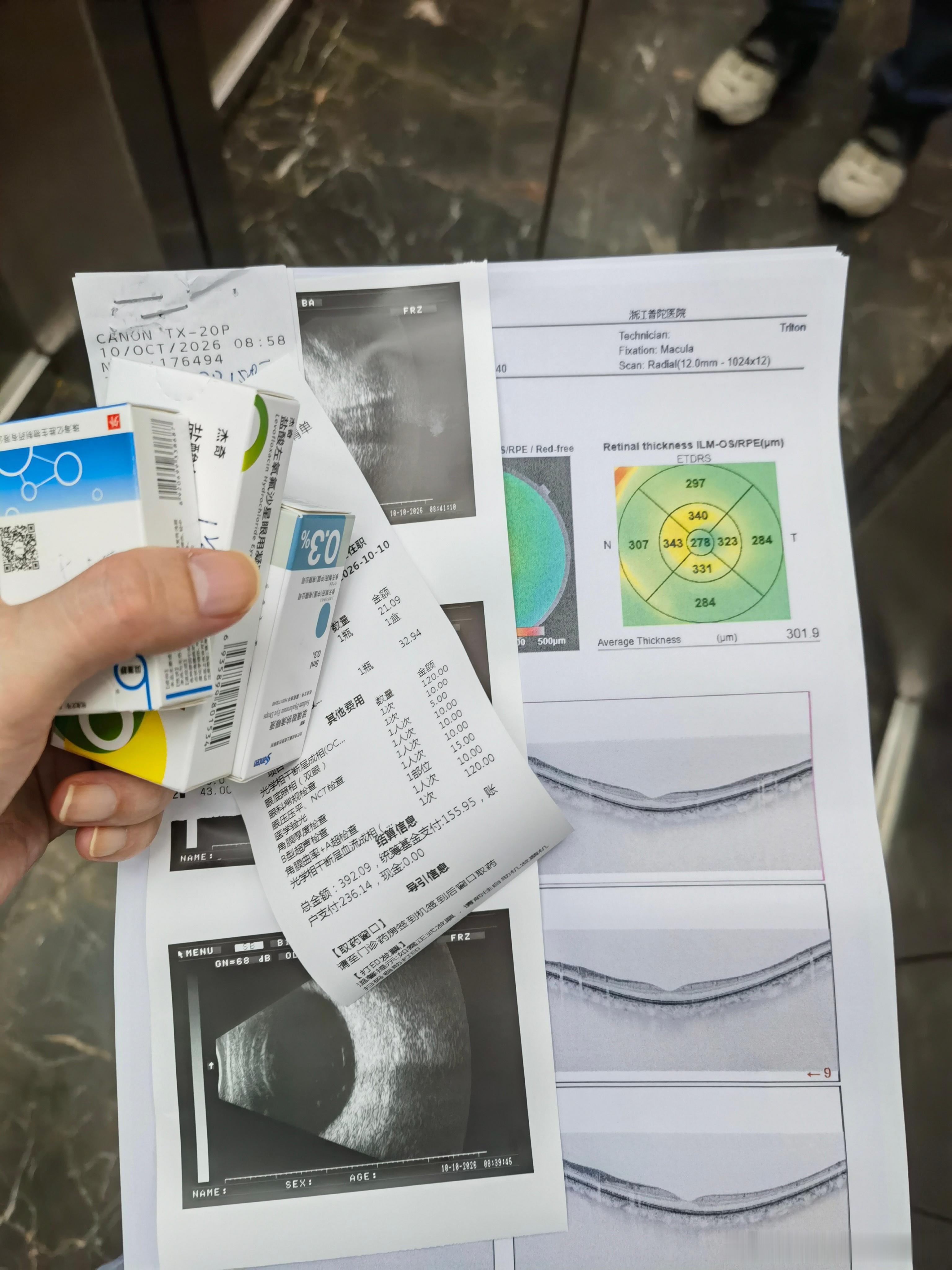最近早上起床后视力模糊持续快2个月了，今天来了趟医院，医生说我高度近视开始有点老