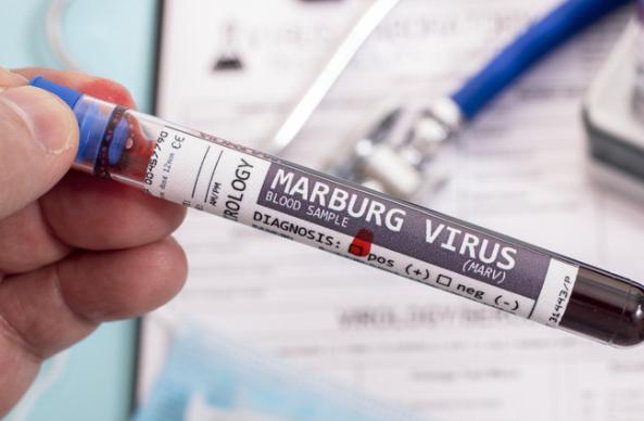 【埃塞俄比亚爆发了致命的马尔堡病毒疫情——该病毒与埃博拉病毒密切相关，目前尚无疫