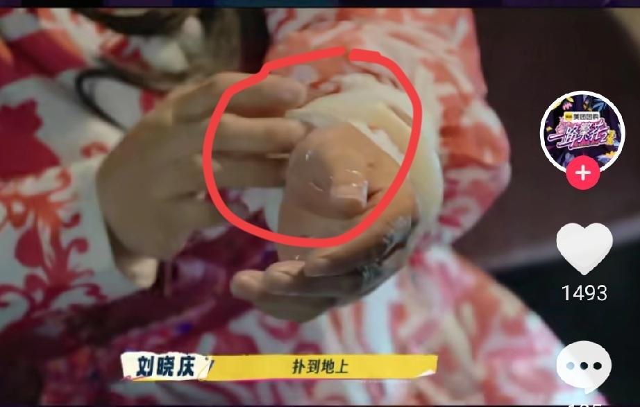 其实明眼人都看出来了
刘晓庆这次摔倒
她本身有个很大的问题
 那就是太“硬核”，