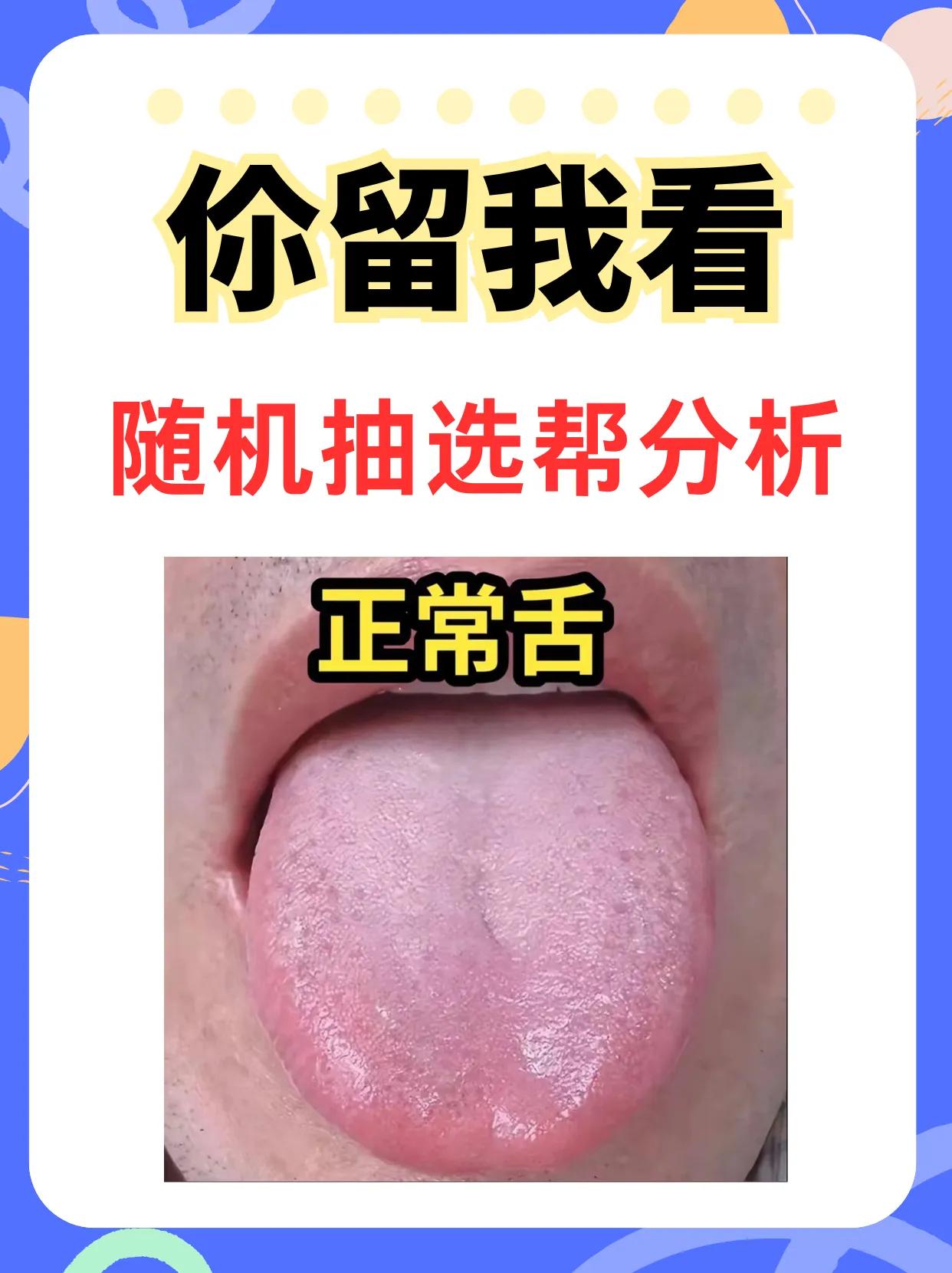 舌象分析
1.肝气郁结 气虚瘀滞
2.脾虚湿重 心肝火旺
3.脾胃虚弱 阳虚
#