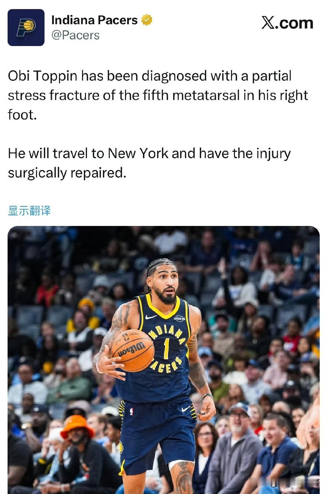 步行者再伤一名大将！！！托平右脚第五跖骨骨折，将前往纽约手术！

根据步行者官方