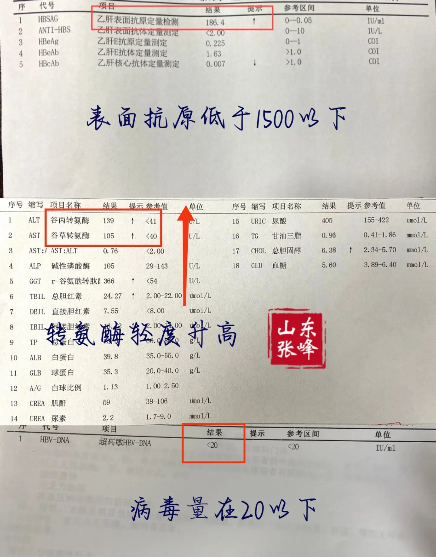 这4类乙肝患者，更容易摘掉乙肝帽子！①表面抗原低于1500以下； ②转...