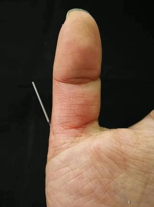 【穴位】：踝灵穴

【定位】：踝灵穴位于手大拇指掌面第一节指骨与大拇指掌骨之间。