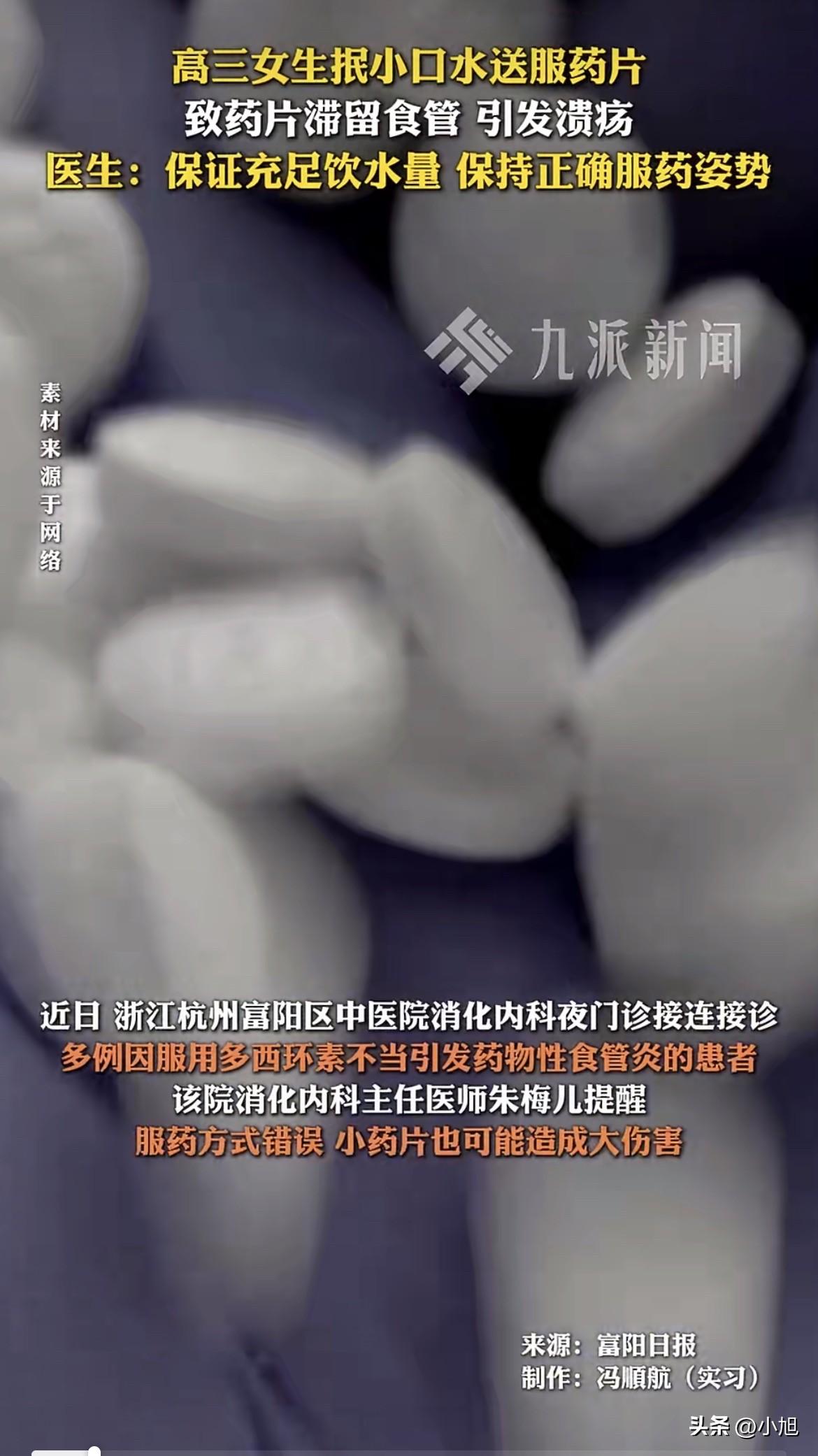 一个高三女生，吞了颗药，食管烧出三段溃疡。
浙江富阳的小方，18岁，前几天被爸妈