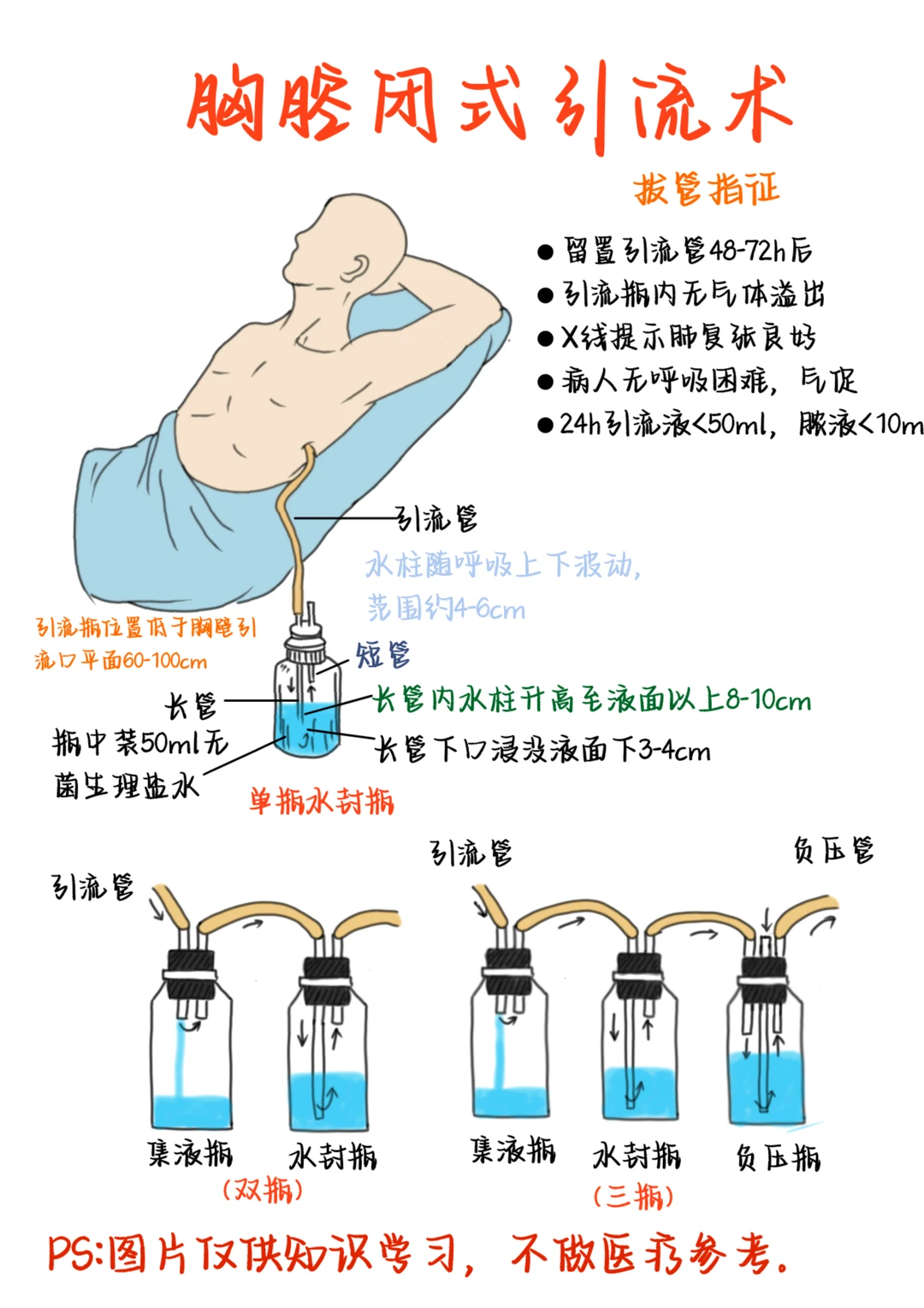 医学生笔记——胸腔闭式引流术