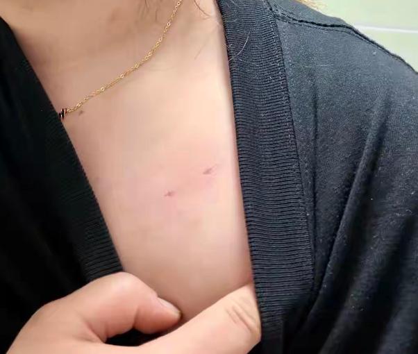 云南昭通，女子独自在家，脱光衣服，一丝不挂的准备洗个澡时，突然，听见卫生间外传来