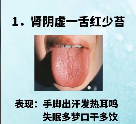 中医帮你辩证，看看你的舌头，有没有中招！
