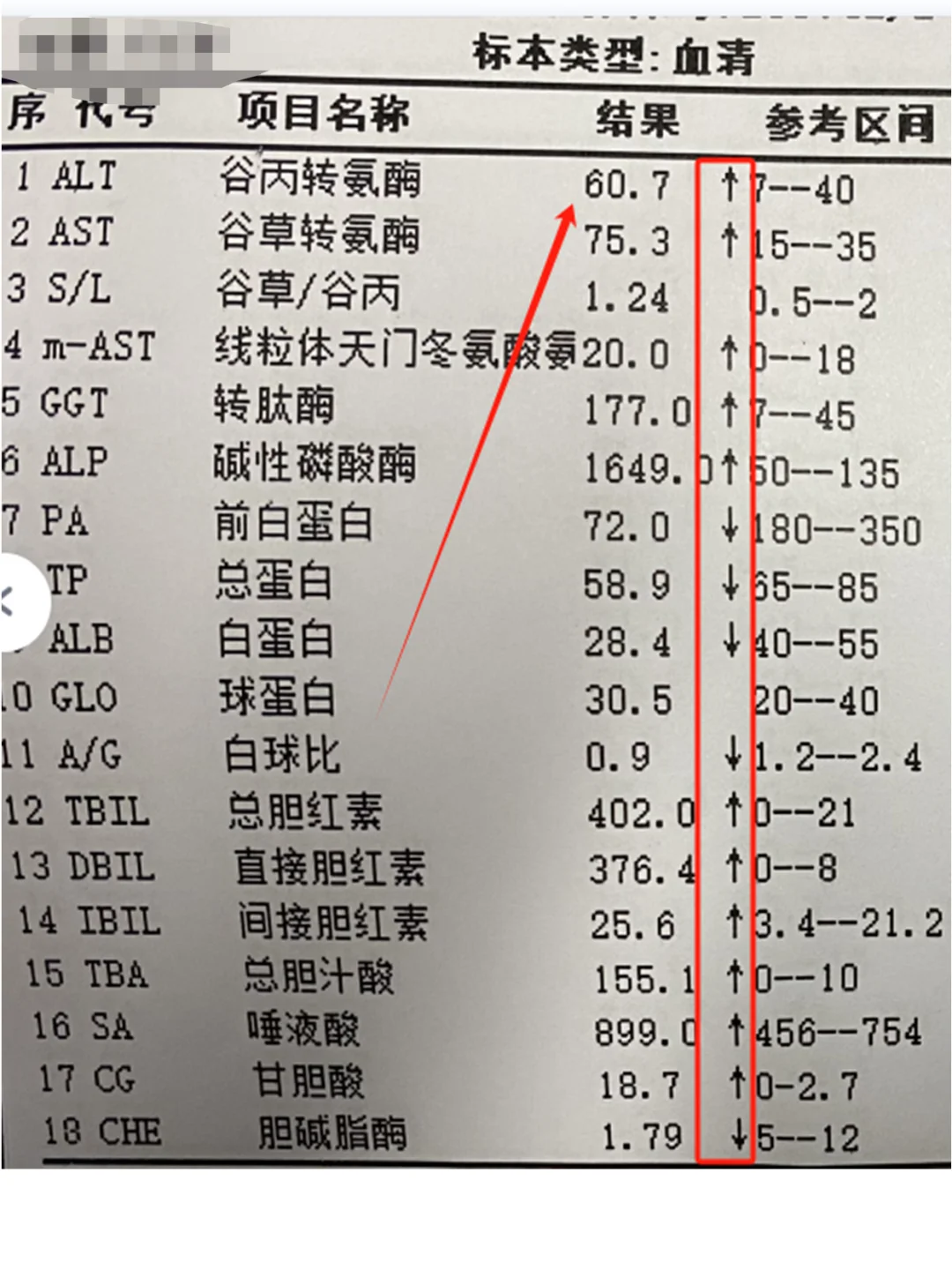 别拿转氨酶高不当回事！