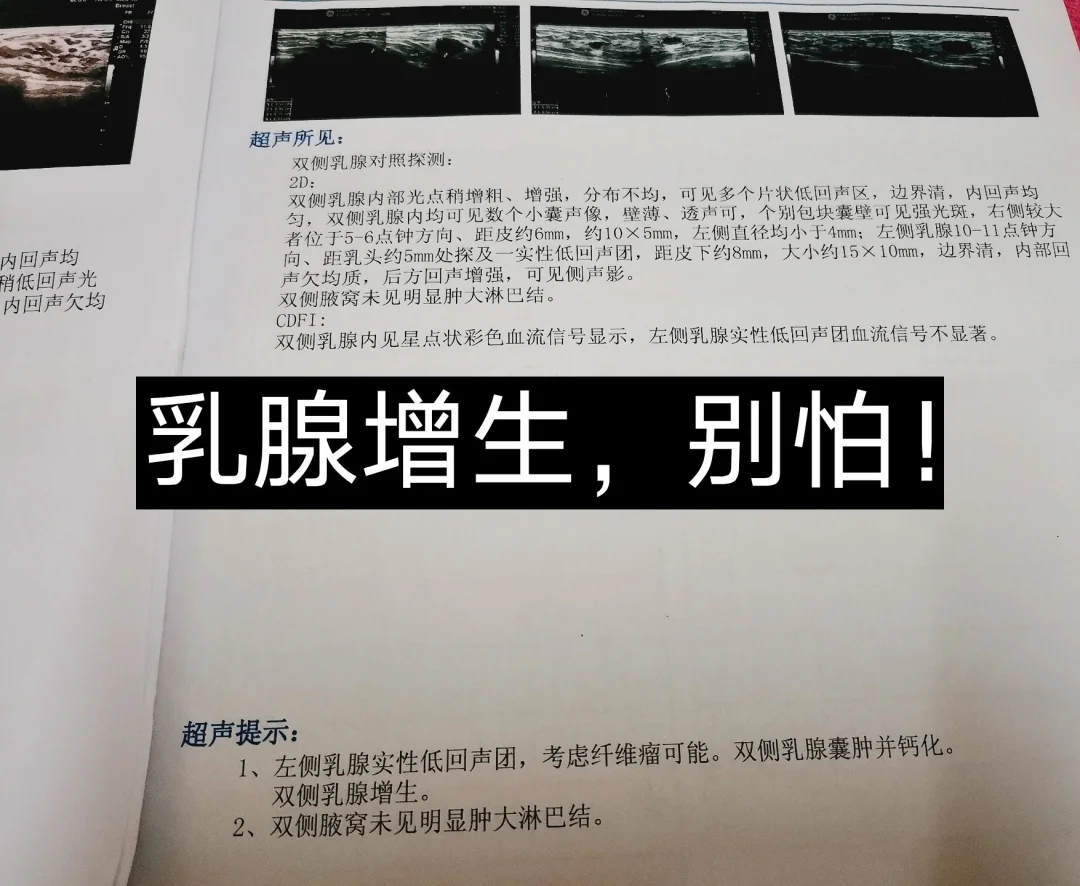 乳腺增生不可怕，心情很重要！