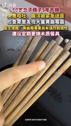 郑州一位大妈平时生活节俭，筷子用了五年，发黑变黄了也舍不得换，结果有一天早上突然