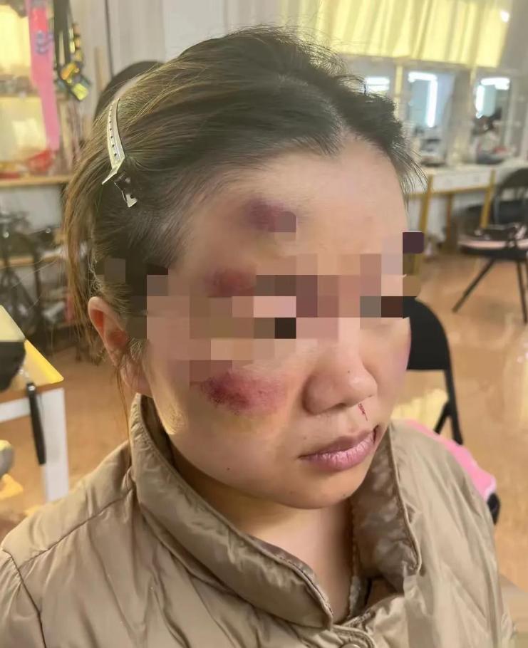 三天前，王敏还缩在墙角承受丈夫的皮带，婆家人却说男人压力大，让她别再计较。三天后
